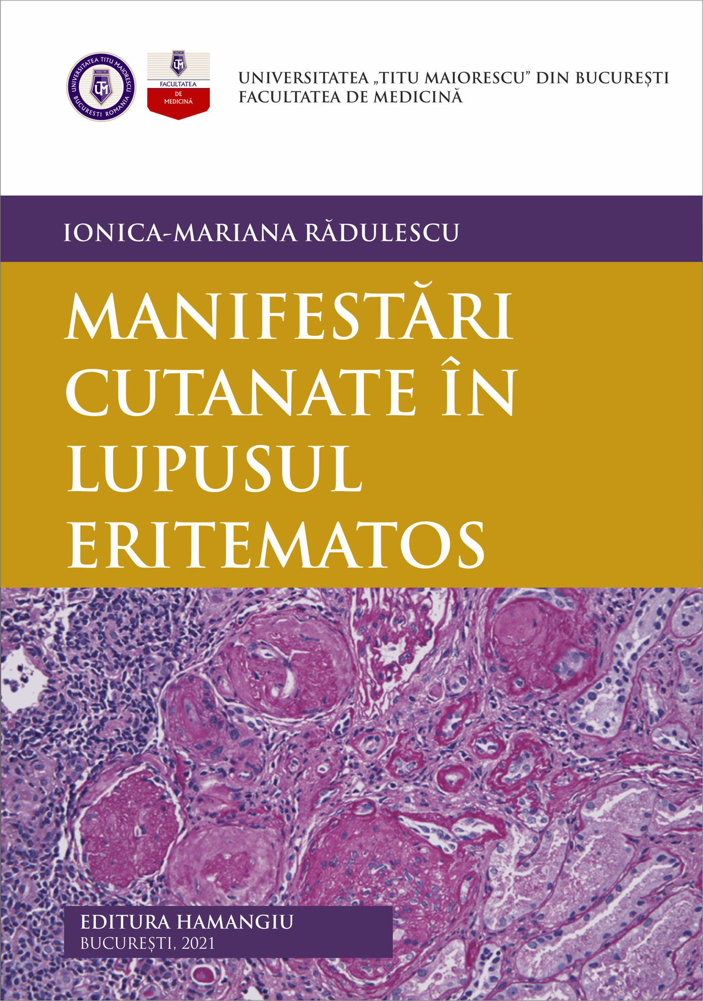 Manifestari cutanate in lupusul eritematos