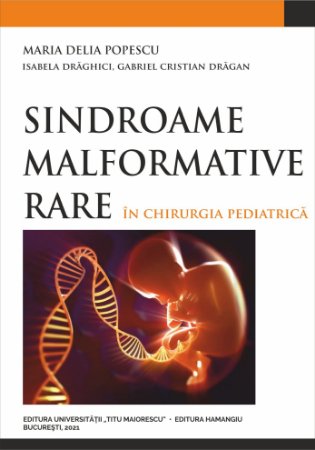 Sindroame malformative rare in chirurgia pediatrica