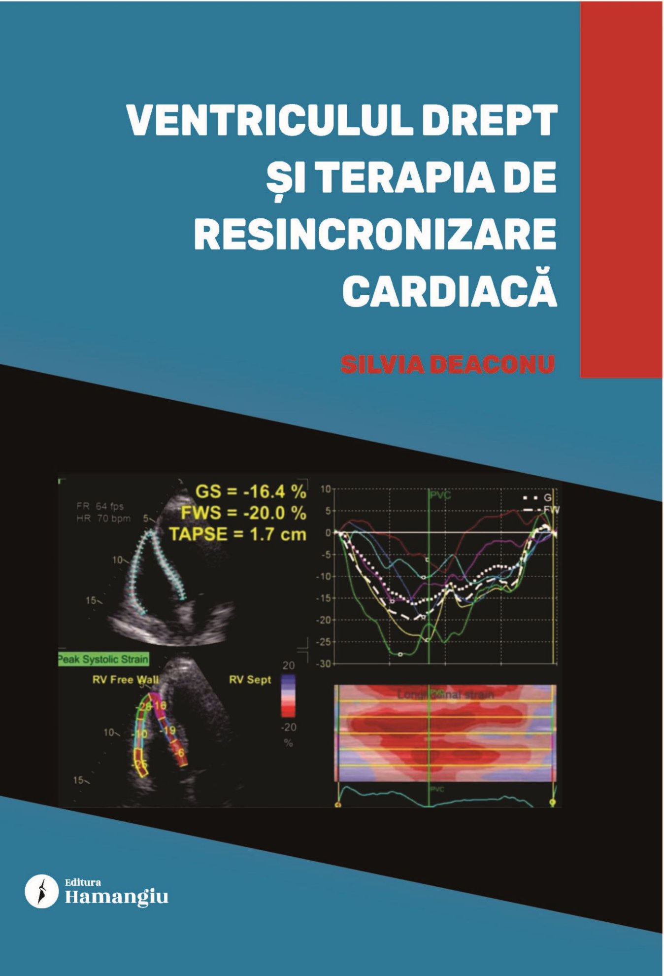 Imagine Ventriculul drept și terapia de resincronizare cardiacă
